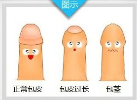 包皮红痒