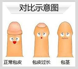 包皮系带手术治疗